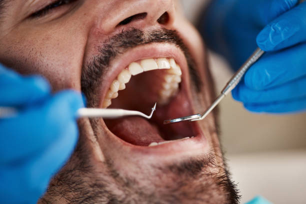 Best Emergency Treatment for Toothache in Magna, UT