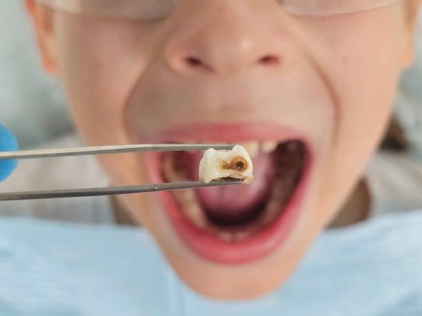 Best Walk-In Emergency Dentist in Magna, UT